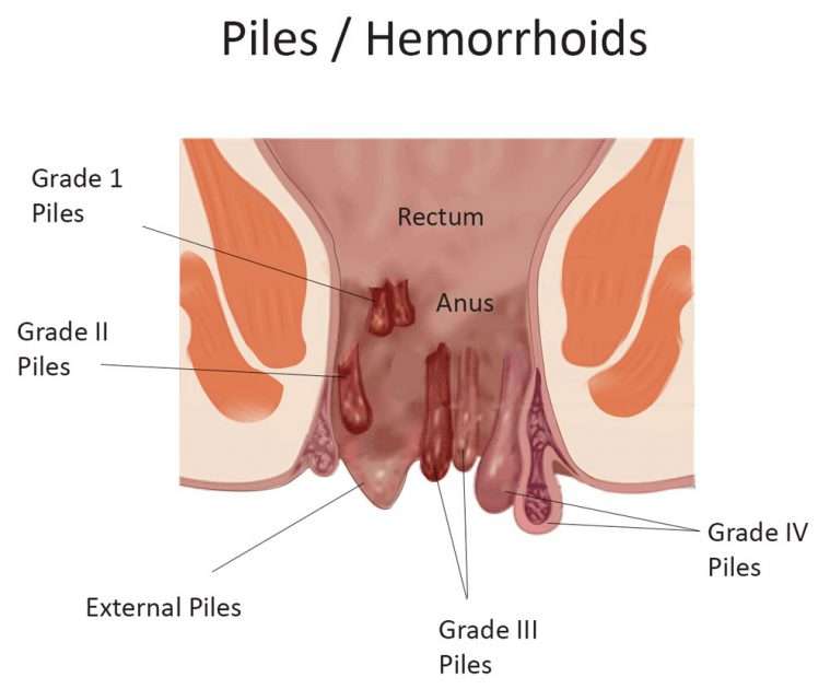 Z9 Homoeopathic Clinic Pulamanthole